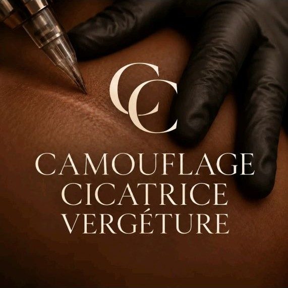Peaux noires et métissées : quand la cicatrice est plus foncée (ou plus claire)